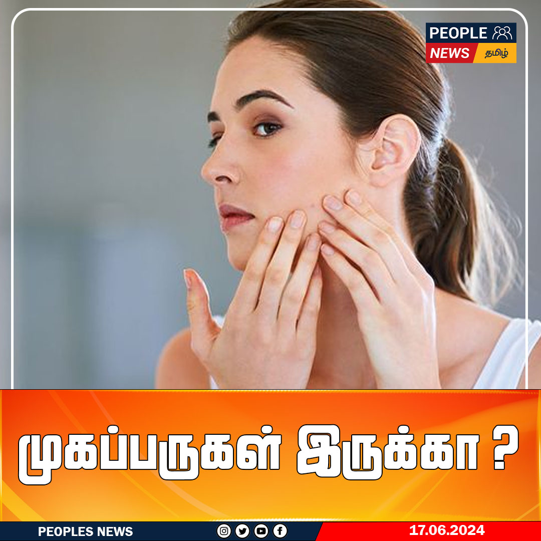 முகப்பருகள் இருக்கா ? 